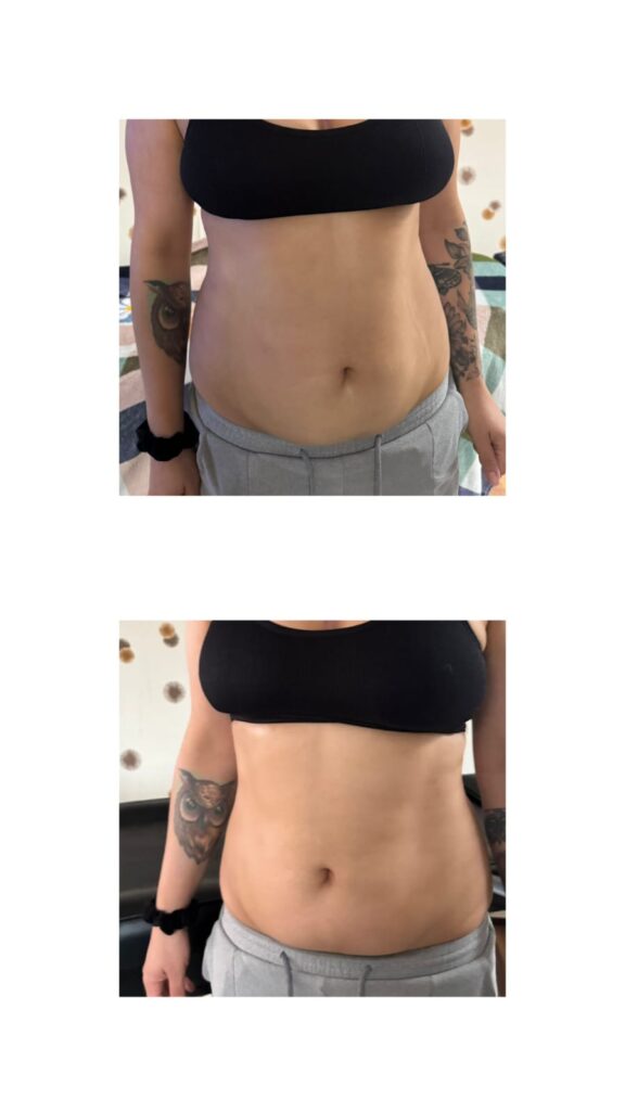 Körperformung_Vorher Nachher